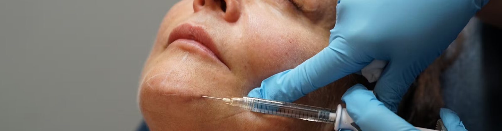 Lower Face Filler Online Banner